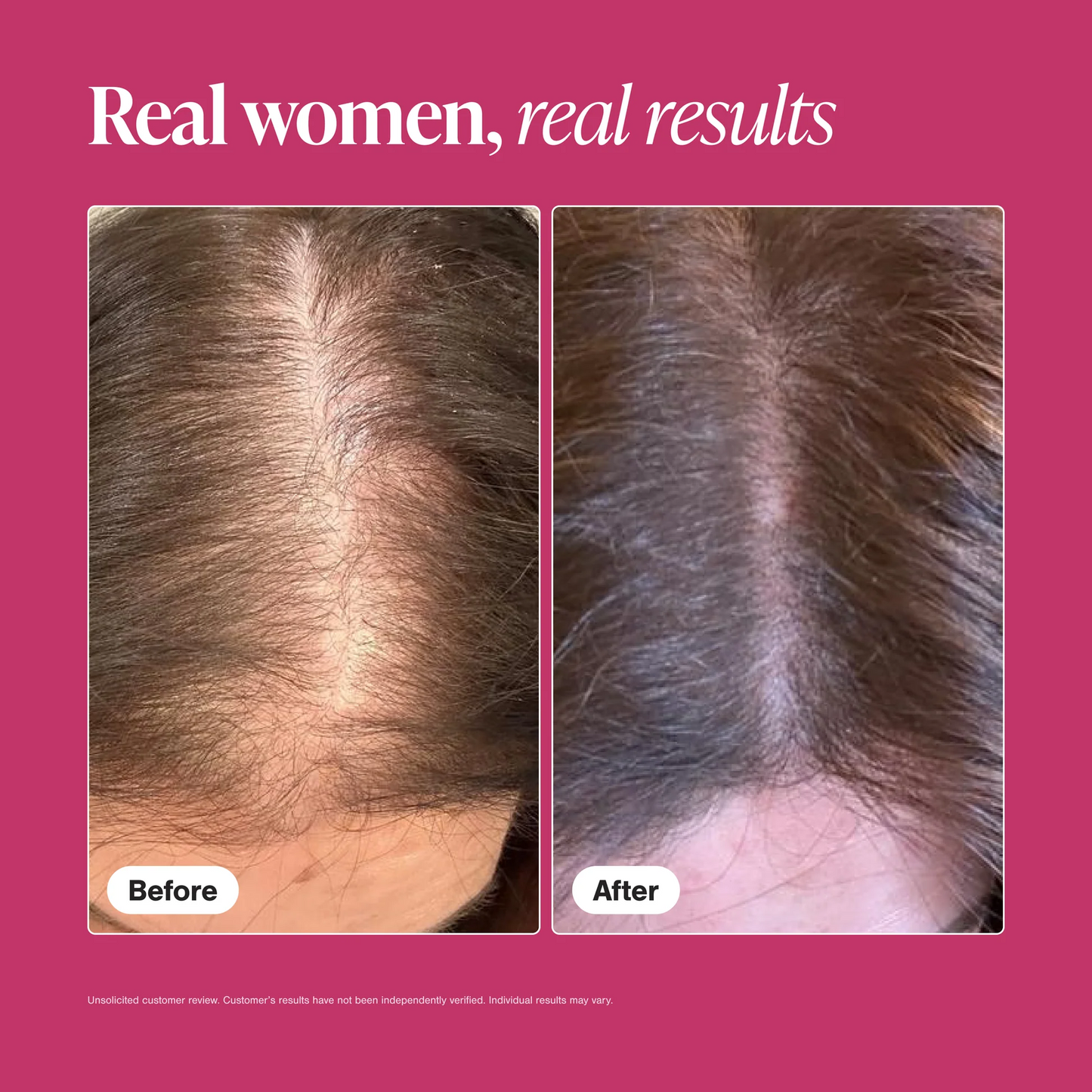 Hair Growth Supplement